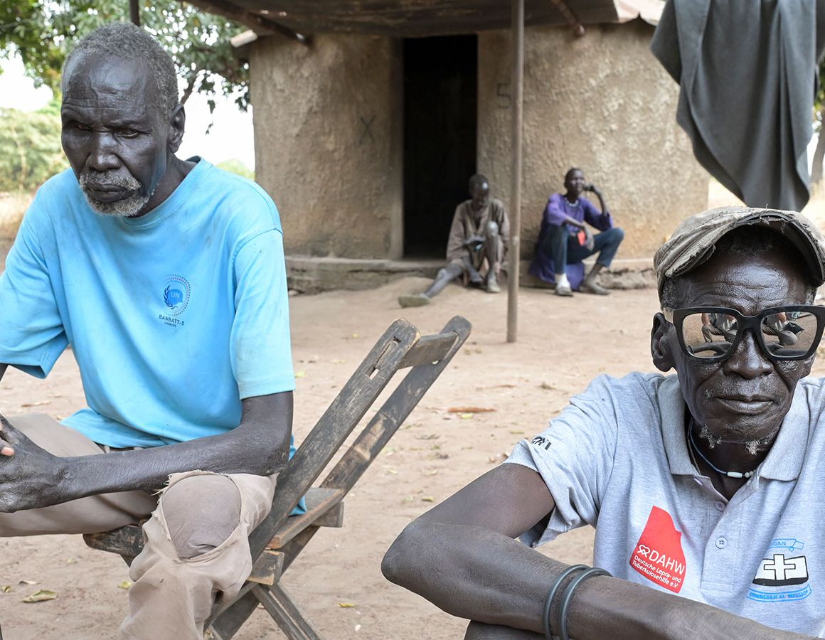 William und Michael sitzen nebeneinander im Lepradorf Agok, den beiden hageren Männern sieht man die Härten des Lebens an